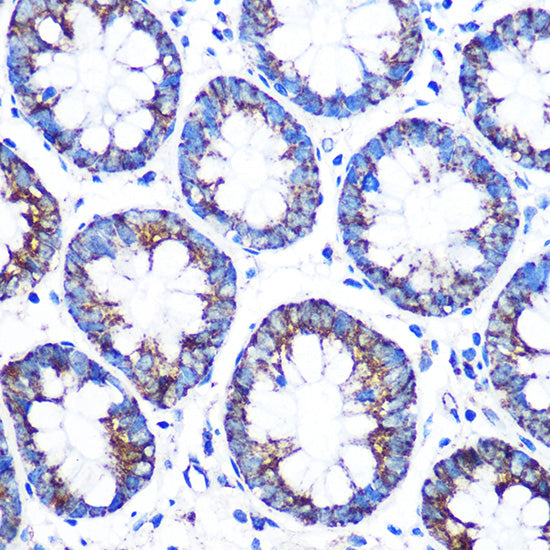 CYP11A1 Rabbit pAb