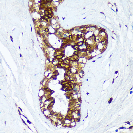 HSD17B7 Rabbit pAb