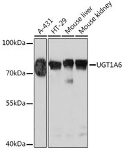 UGT1A6 Rabbit pAb