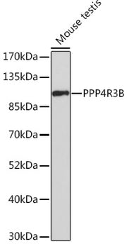 PPP4R3B Rabbit pAb
