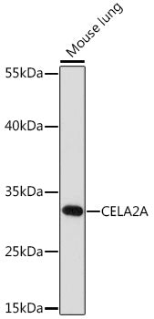 CELA2A Rabbit pAb