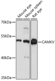 CAMKV Rabbit pAb