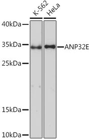 ANP32E Rabbit pAb