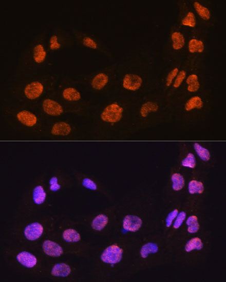 MAML2 Rabbit pAb