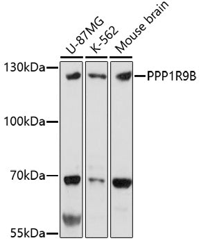 PPP1R9B Rabbit pAb