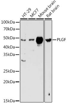 PLGF Rabbit pAb