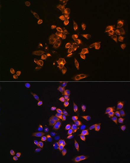 [KO Validated] Annexin A5/Annexin V Rabbit pAb
