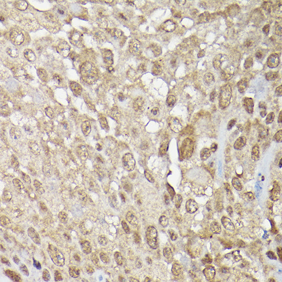 MAPK1/MAPK3 Rabbit pAb