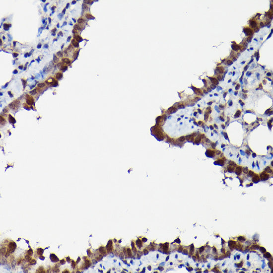MAPK1/MAPK3 Rabbit pAb