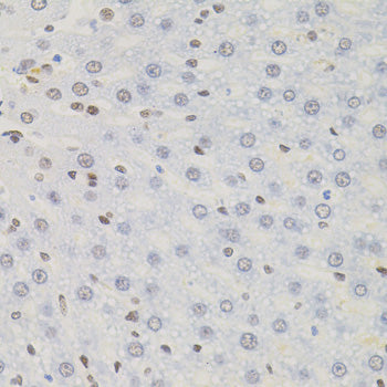 AKAP8 Rabbit pAb