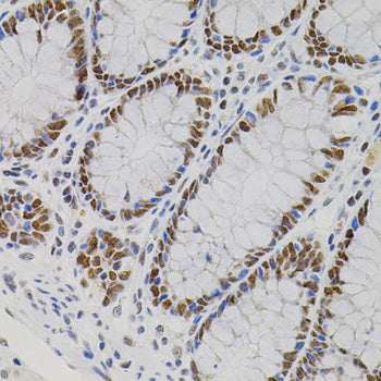 AKAP8 Rabbit pAb