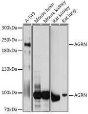 AGRN Rabbit pAb