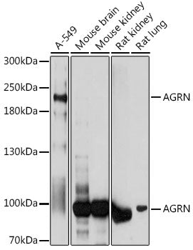 AGRN Rabbit pAb