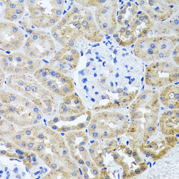 HDAC6 Rabbit pAb