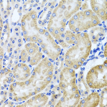 HDAC6 Rabbit pAb