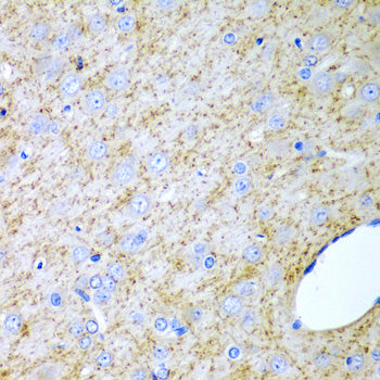 Inhibin alpha (INHA) Rabbit pAb