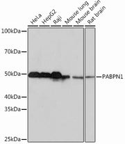 PABPN1 Rabbit mAb