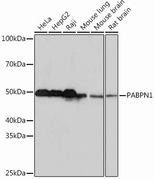 PABPN1 Rabbit mAb