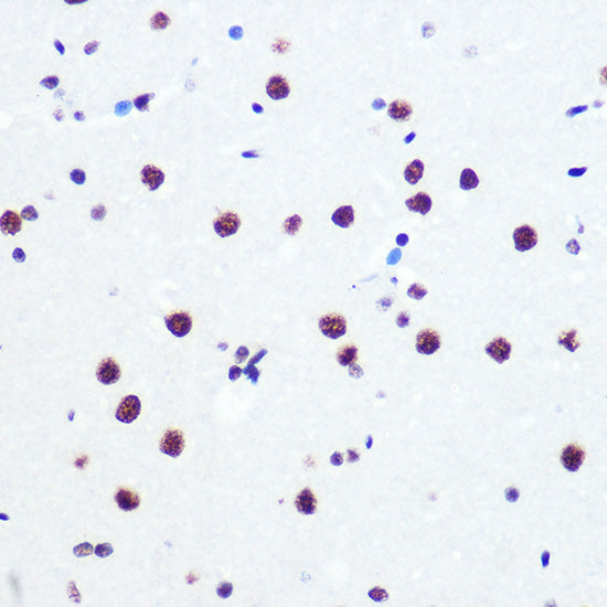 PABPN1 Rabbit mAb