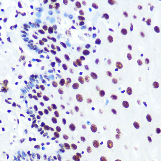 PABPN1 Rabbit mAb