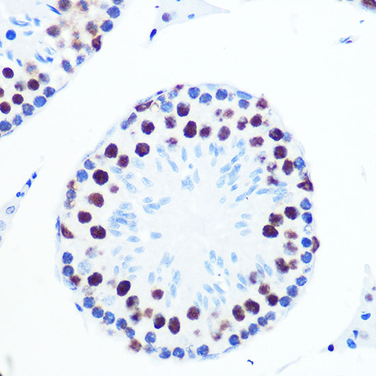 PABPN1 Rabbit mAb