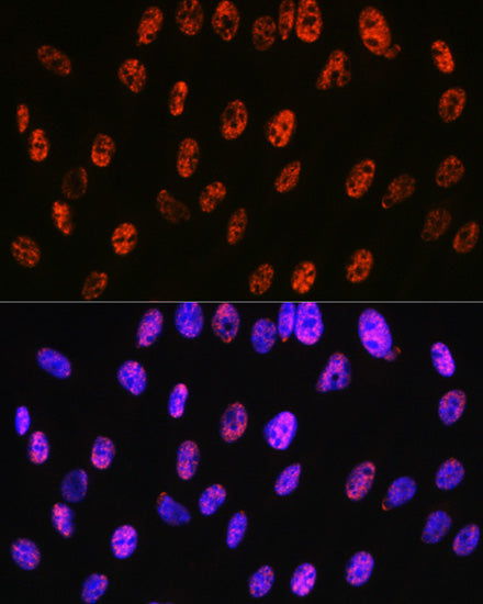 PABPN1 Rabbit mAb