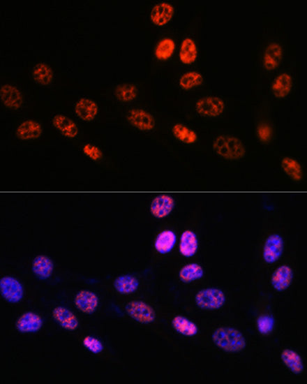 PABPN1 Rabbit mAb