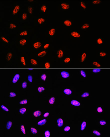 PABPN1 Rabbit mAb