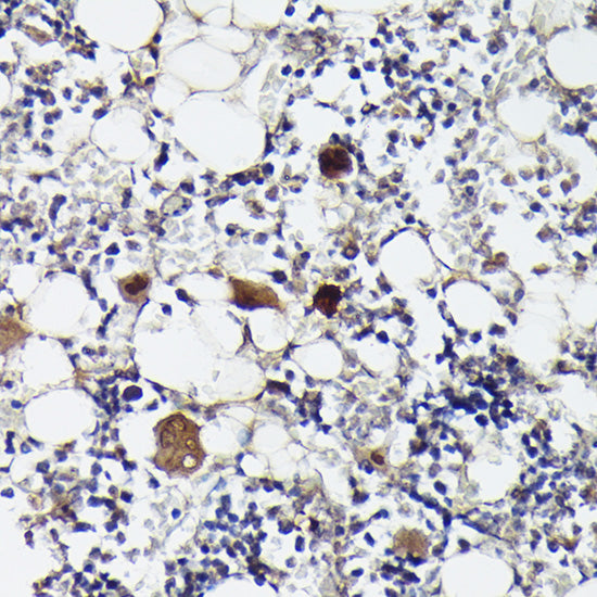 CXCL4/PF4 Rabbit pAb
