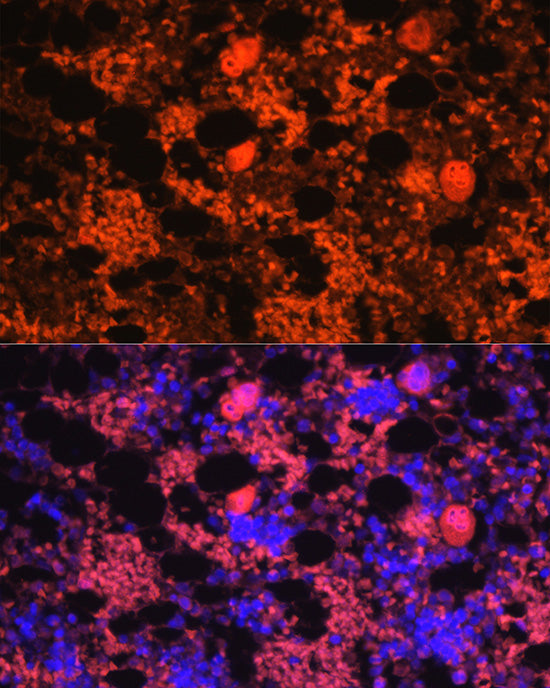 CXCL4/PF4 Rabbit pAb