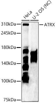 ATRX Rabbit pAb
