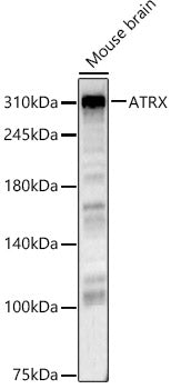 ATRX Rabbit pAb