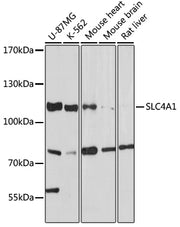 SLC4A1 Rabbit pAb