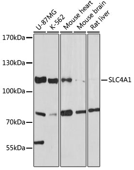 SLC4A1 Rabbit pAb