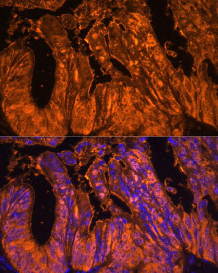 Galectin 4/LGALS4 Rabbit pAb