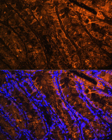 Galectin 4/LGALS4 Rabbit pAb