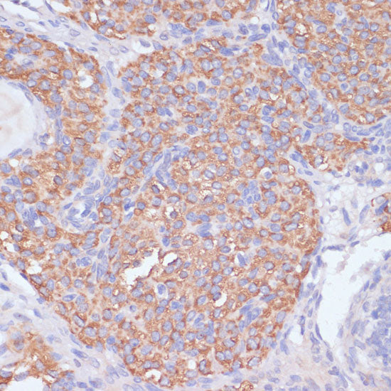 PI3 Kinase p85 beta Rabbit pAb