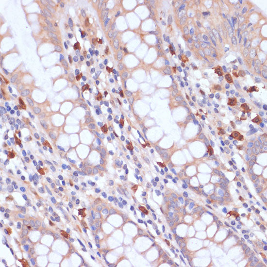 PI3 Kinase p85 beta Rabbit pAb