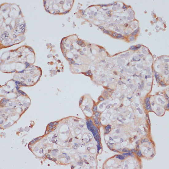 PI3 Kinase p85 beta Rabbit pAb