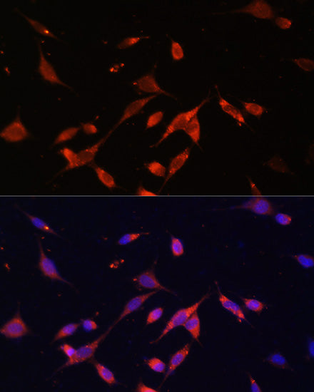 PI3 Kinase p85 beta Rabbit pAb