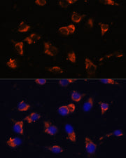 CA19-9 Mouse mAb