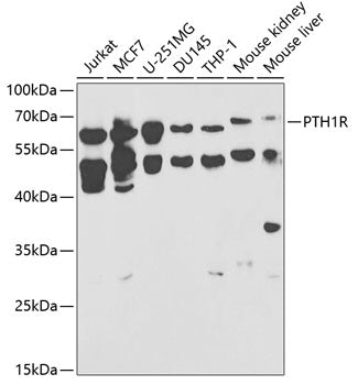 PTH1R Rabbit pAb