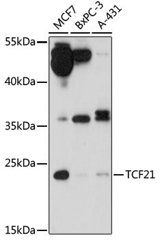 TCF21 Rabbit pAb