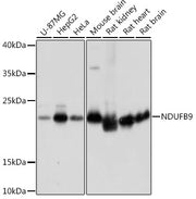 NDUFB9 Rabbit pAb