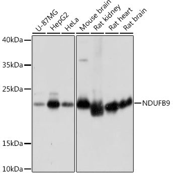 NDUFB9 Rabbit pAb