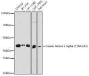 Casein Kinase 2 alpha (CSNK2A1) Rabbit pAb