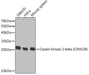 Casein Kinase 2 beta (CSNK2B) Rabbit pAb