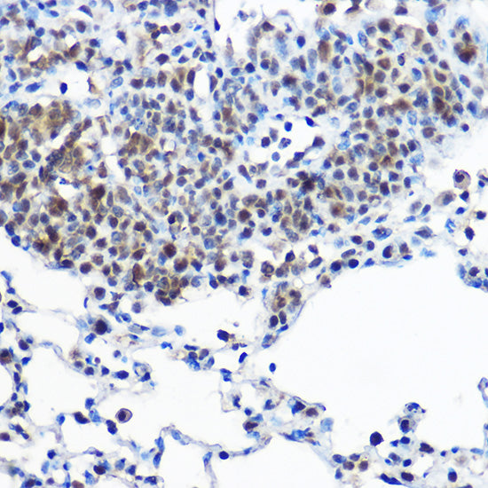 Casein Kinase 2 beta (CSNK2B) Rabbit pAb