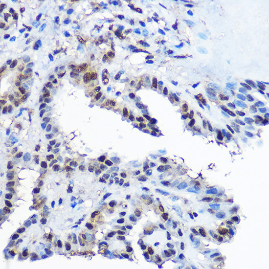 Casein Kinase 2 beta (CSNK2B) Rabbit pAb