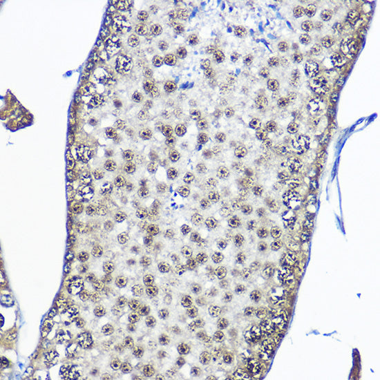 Casein Kinase 2 beta (CSNK2B) Rabbit pAb